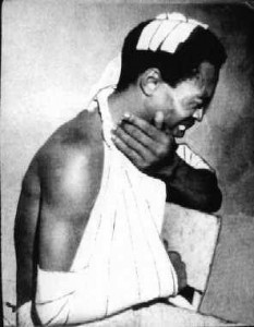 Fela Anikulapo Kuti in bandages after being beat up by military officers.
